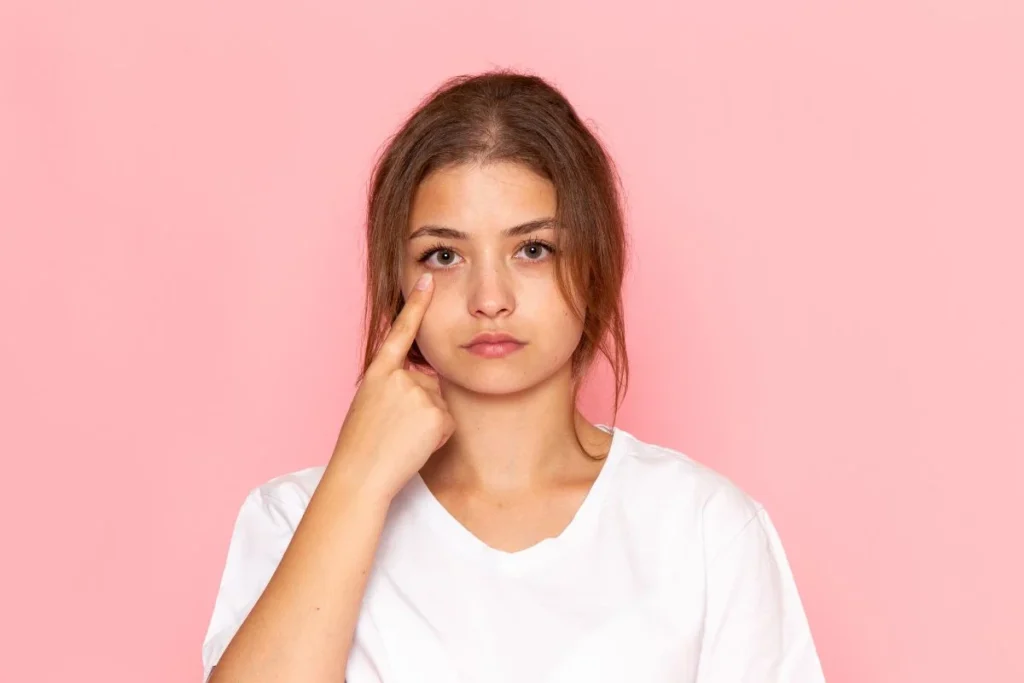 How to Reduce Dark Circles Naturally